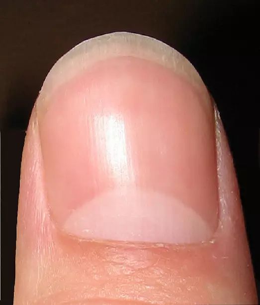 手指甲月芽图片
