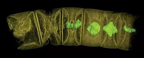 科学家已经创造出人工视网膜植入物，可以恢复数百万人的视力！